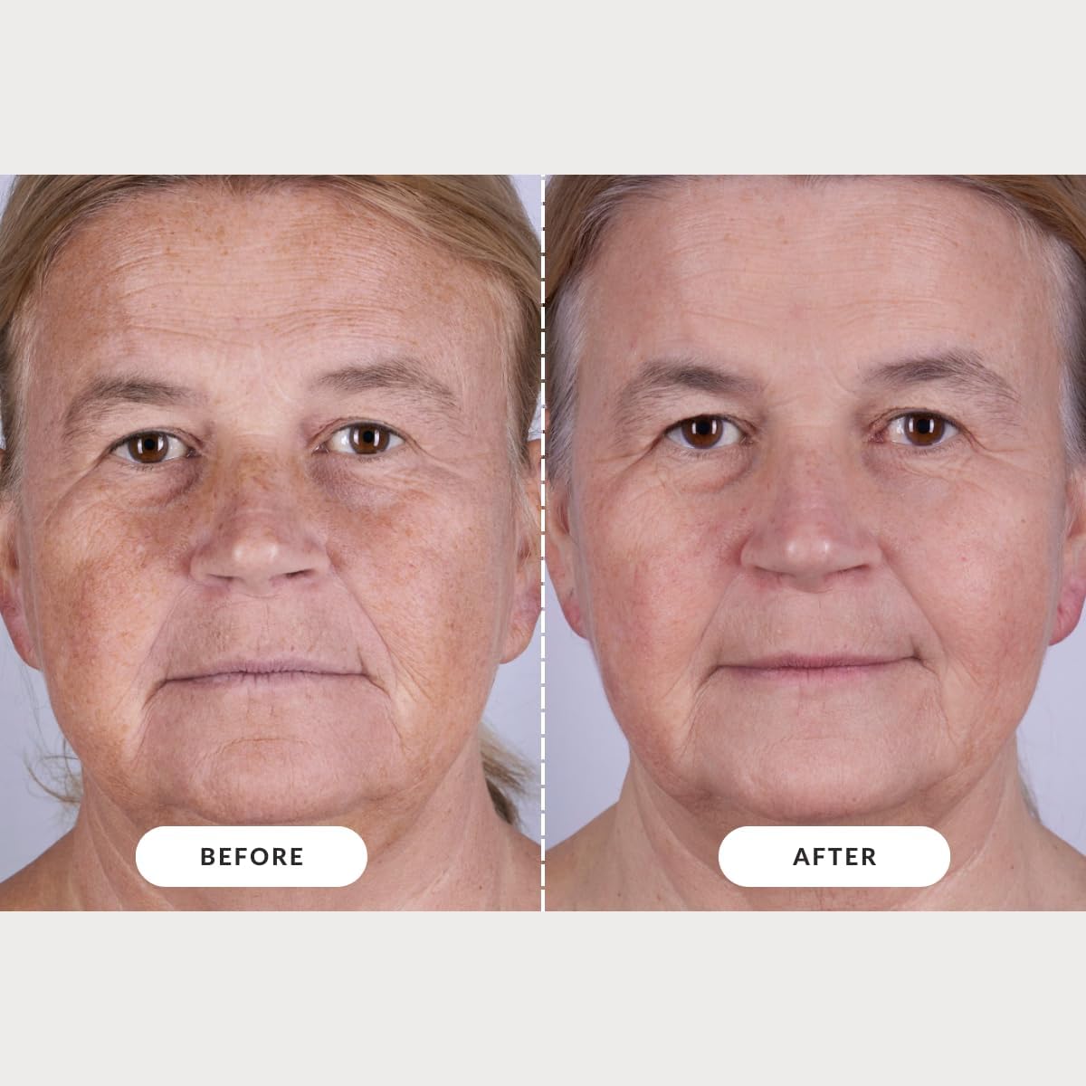CurrentBody Skin Masque LED visage rouge Série 2 Technologie rouge et infrarouge