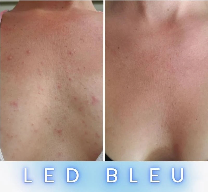 Masque LED Anti-Âge Pro - Cou et Décolleté FontanaySkin